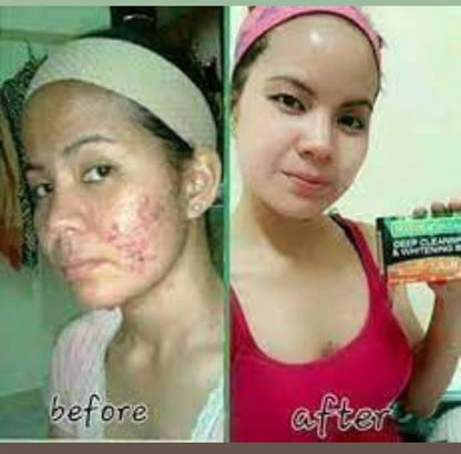 NaturaCentials Deep Cleansing &amp; Whitening Bar