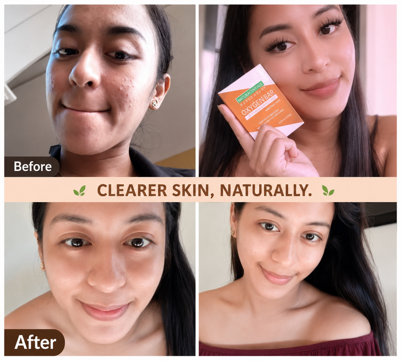 K-SOAP Korean Anti-Aging Oxygen Soap – Premium Skin Care