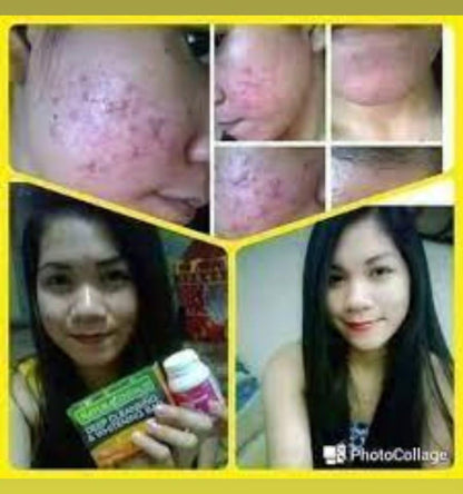 NaturaCentials Deep Cleansing &amp; Whitening Bar