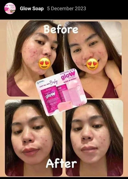 ChokChok Glow – Korean Collagen Soap with Niacinamide, Hyaluronic Acid & Vitamin C